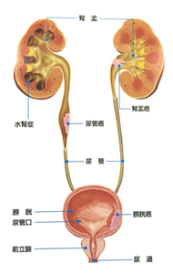 泌尿器